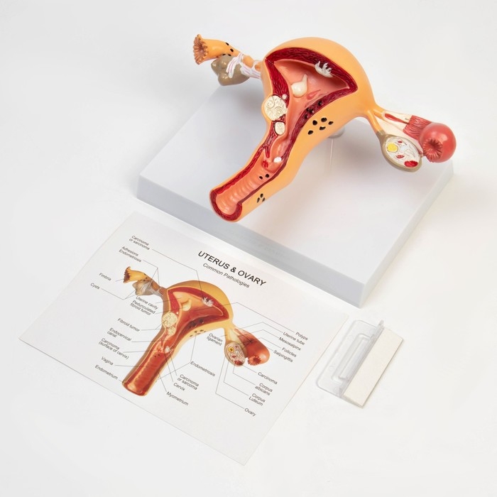Макет Макет "Органы матки, патологии" 24*12*20см