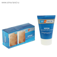 Крем "До и После" Антицеллюлитный, 100мл