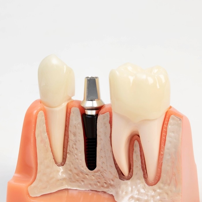 Макет Макет "Строение зуба" 9*6*9см