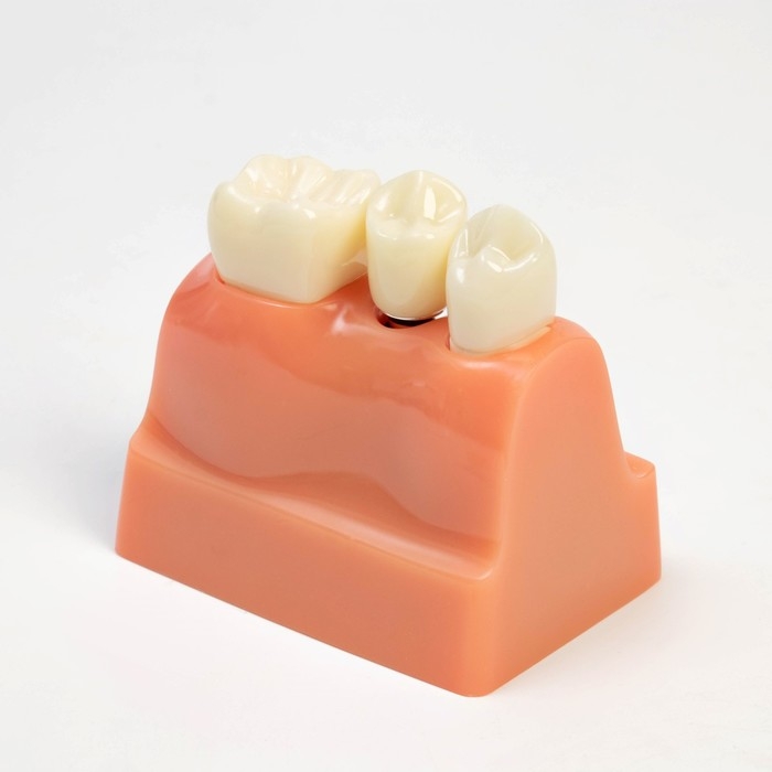 Макет Макет "Строение зуба" 9*6*9см