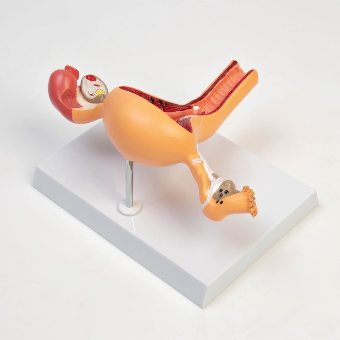 Макет Макет "Органы матки, патологии" 24*12*20см