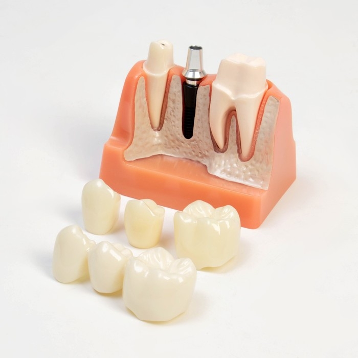 Макет Макет "Строение зуба" 9*6*9см