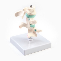 Макет "Позвоночник в разрезе" 8*7см