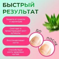 Масло для кутикулы в карандаше «Алоэ» Масло для кутикулы в карандаше «Алоэ»