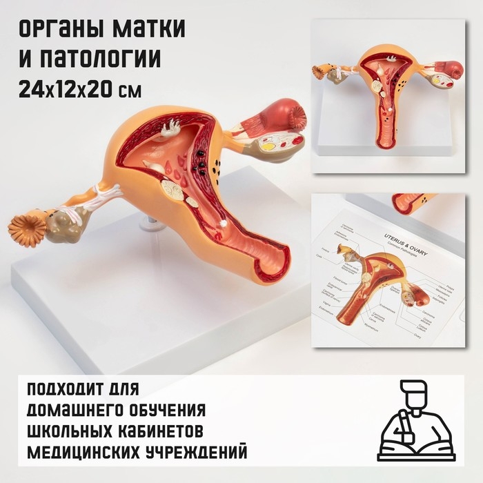 Макет Макет "Органы матки, патологии" 24*12*20см